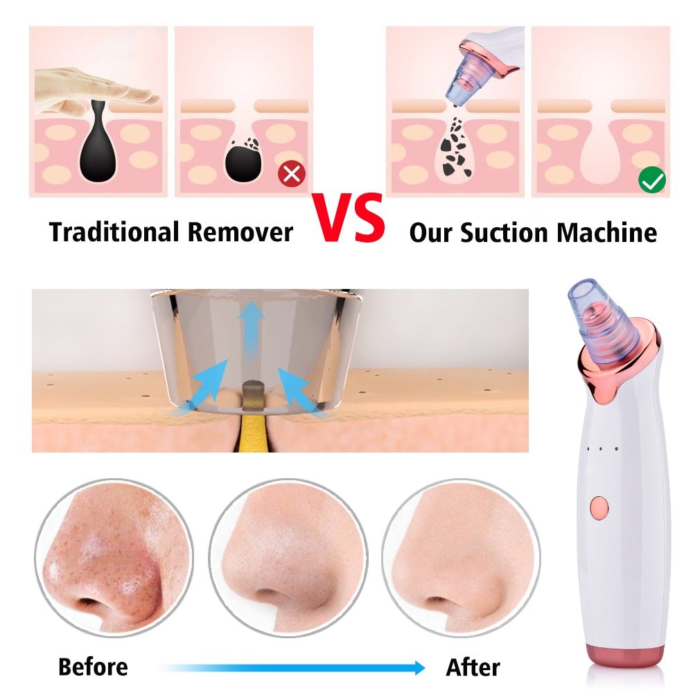 Blackhead Instrument Electric Suction Facial Washing Instrument Beauty Acne Cleaning Blackhead Suction Instrument - 𝓢𝓱𝓸𝓹𝓵𝓮𝓬𝔂