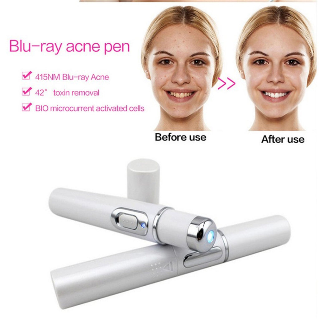 Blue Light Therapy Acne Laser Pen Soft Scar Wrinkle Removal Treatment Device Skin Care Beauty Equipment - 𝓢𝓱𝓸𝓹𝓵𝓮𝓬𝔂