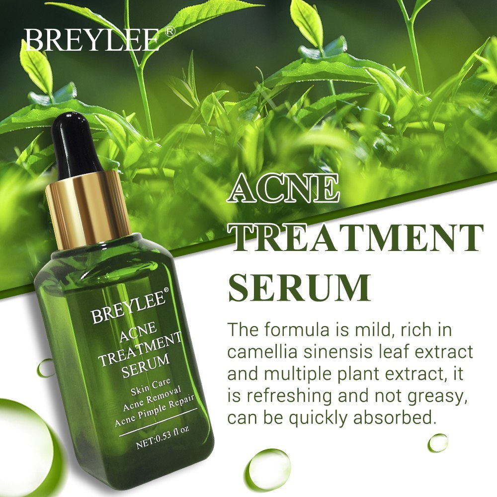 BREYLEE Acne Treatment Serum Face Facial Anti Acne Scar Removal Cream Skin Care Whitening Repair Pimple Remover For Acne - 𝓢𝓱𝓸𝓹𝓵𝓮𝓬𝔂