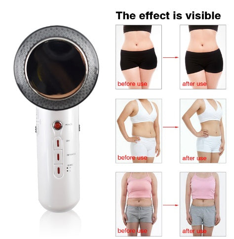 Beauty Care Slimming Device Handheld Ultrasound Body Fat Remove Massager - 𝓢𝓱𝓸𝓹𝓵𝓮𝓬𝔂