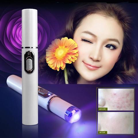 Blue Light Therapy Acne Laser Pen Soft Scar Wrinkle Removal Treatment Device Skin Care Beauty Equipment - 𝓢𝓱𝓸𝓹𝓵𝓮𝓬𝔂