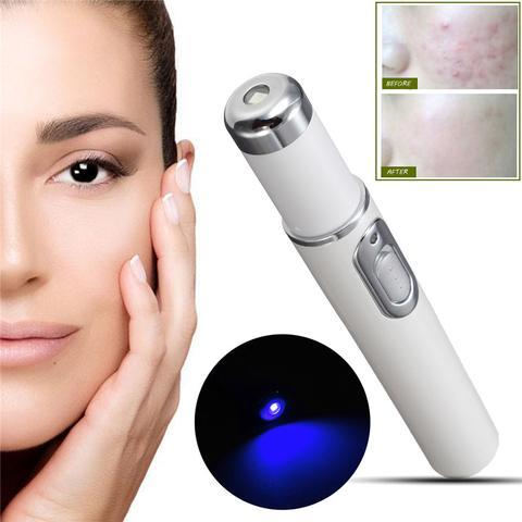 Blue Light Therapy Acne Laser Pen Soft Scar Wrinkle Removal Treatment Device Skin Care Beauty Equipment - 𝓢𝓱𝓸𝓹𝓵𝓮𝓬𝔂
