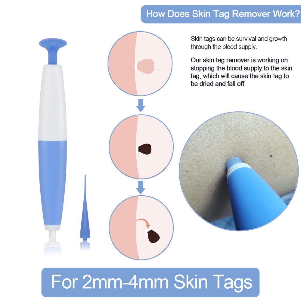 Skin Tag Removal Kit Home Use Mole Wart Remover Micro Band Skin Tag Treatment Tool Easy To Clean Skin Care Tool - 𝓢𝓱𝓸𝓹𝓵𝓮𝓬𝔂