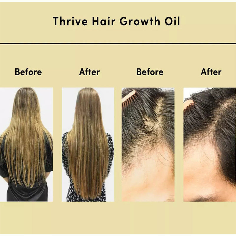 Hair Essential Oil Improve Dryness And Irritability And Nourish - 𝓢𝓱𝓸𝓹𝓵𝓮𝓬𝔂